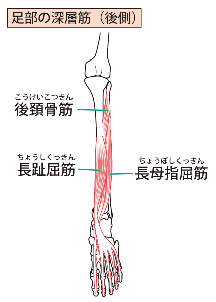 シンスプリントとは